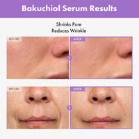 Thumbnail for TOSOWOONG Bakuchiol Serum, 5,000ppm Bakuchiol, Anti-Aging, Pore Minimizer for Face, Hydrating Glow Serum, Facial Moisturizer, Active Skin Repair, Glass Skin, Korean Skincare, 30ml, 1.01 fl. oz.