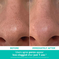 Thumbnail for Peter Thomas Roth | Even Smoother™ Microdermabrasion Exfoliating Pore Purifier with Salicylic Acid for Oil Control