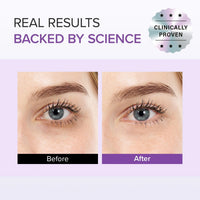 Thumbnail for Mary&May Tranexamic Acid + Glutathione Eye Cream (30ml) - Korean Skincare for Dark Circles & Uneven tone - Fragrance-Free Under Eye Cream for Dark Spots & Hyperpigmentation 1.01oz.