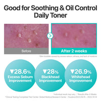 Thumbnail for numbuzin No.1 Toner | Pure-Full Calming Herb Toner | Breakouts, Redness, Excess Oil Control | Centella Asiatica, Heartleaf, Licorice Root | Acne-Prone, Sensitive Skin | 10.14 fl. oz.