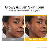 Thumbnail for numbuzin No.5 Vitamin Concentrated Serum, Dark Spot Care, Glutathione & Vitamin Serum, Korean Skincare, Tranexamic Acid 4%, Niacinamide 5%, for a Radiant-Looking Glow 1.01 fl oz