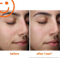 Thumbnail for Kate Somerville ExfoliKate Cleanser – Daily Exfoliating Foaming Face Wash, Clinically Formulated Glycolic Acid and Lactic Acid Gentle Facial Scrub, Travel-Size, 1.7 Fl Oz