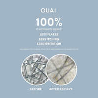 Thumbnail for OUAI Detox Shampoo (10 fl oz) & Anti-Dandruff Deluxe Size (1 fl oz) Bundle - Soothing, Clarifying Shampoo Set for Dry, Flaky Scalp - Removes Dirt & Build Up (2 Count)