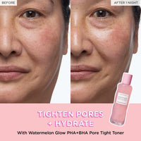Thumbnail for Glow Recipe PHA + BHA Face Toner - Korean Skin Care Pore Minimizer & Gentle Facial Exfoliator for Tightening, Hydrating & Exfoliating - Glycerin, Watermelon & Cactus Water (150ml)