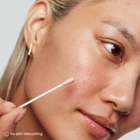 Thumbnail for Kate Somerville EradiKate Acne Treatment - Clinically Formulated 10% Sulfur and BHA Spot Treatment – Clears Pimples, Cleans Pores and Prevents Breakouts, 1 Fl Oz