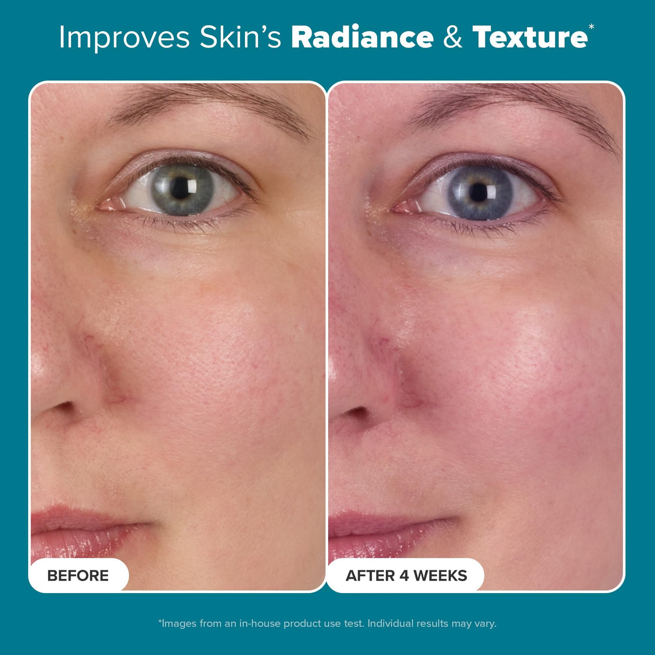 Paula's Choice Skin Balancing Pore-Reducing Face Toner with Niacinamide, for Oily Skin & Combination, Minimizes Large Pores, Controls Oil & Shine, Hydrates & Replenishes, Fragrance-Free, 6.4oz