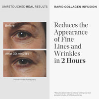 Thumbnail for Murad Rapid Collagen Infusion – Anti-Aging Serum with Collagen Amino Acids & Winged Kelp Extract for Visible Wrinkle Reduction, Enhanced Skin Firmness & Re-Volumizes Skin – 1.0 Fl Oz