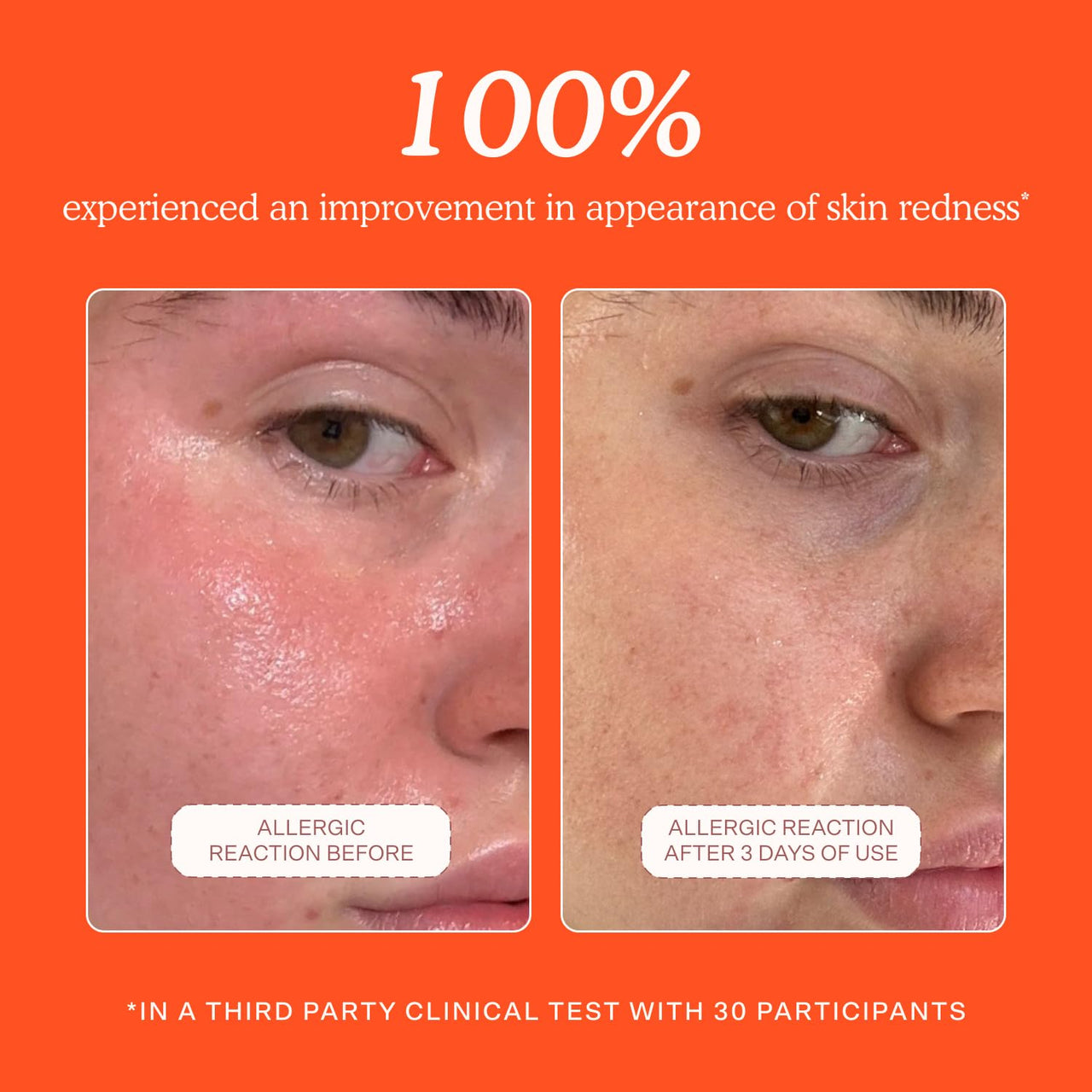 Tower 28 SOS Daily Rescue Facial Spray - Hypochlorous Acid Spray to Help Reduce Redness, Calm Irritation + Alleviate Flare-Ups - Soothing + Purifying Face Toner - Everyday Skin Care Essential (4 oz)