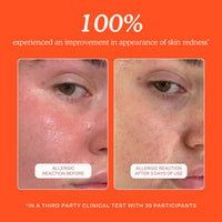 Thumbnail for Tower 28 SOS Daily Rescue Facial Spray - Hypochlorous Acid Spray to Help Reduce Redness, Calm Irritation + Alleviate Flare-Ups - Soothing + Purifying Face Toner - Everyday Skin Care Essential (4 oz)