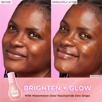 Thumbnail for Glow Recipe Watermelon Niacinamide Dew Drops, Korean Niacinamide Serum Drops, Hydrating Face Serum + Primer & Liquid Highlighter, Hyaluronic Acid, Dewy Glow (40ml)