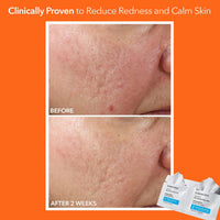 Thumbnail for Dr. Dennis Gross Alpha Beta Ultra Gentle Daily Peel: for Dehydrated or Sensitive Skin, Uneven Tone or Texture, Fine Lines or Enlarged Pores (5 Treatments)