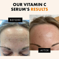 Thumbnail for Eclat Skincare Vitamin C Serum - Skin Care for Dark Spots, Vitamin C Serum for Face with Hyaluronic Acid, Ferulic Acid, & Vit E - Anti Aging and Skin Brightening Vit C Formula for Face Care 1 Fl Oz