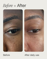 Thumbnail for Topicals Sealed Active Scar Filling Primer for Acne Prone Skin - Good for Blemishes, Pores, Acne & Dryness - Contains Retinol and Salicylic Acid - 1 Oz