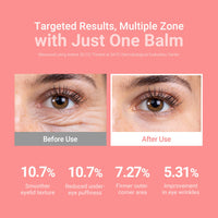 Thumbnail for KAHI Wrinkle Bounce Multi Balm Stick | PDRN Collagen Wrinkle Stick | Korean Skin Care |All-in-One Hydrating Lip Balm Eye Cream Neck Cream Make Up Base & Face Mist Moisture Balm
