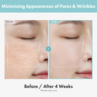 Thumbnail for TOSOWOONG Pore Refiner Cream, Pore Minimizer with AHA - Glycolic Acid and Lactic Acid, Oil Control Face Moisturizer for Oily Skin, Texture Smoothing for Fine Lines, Korean Skincare, 50g / 1.76 oz.