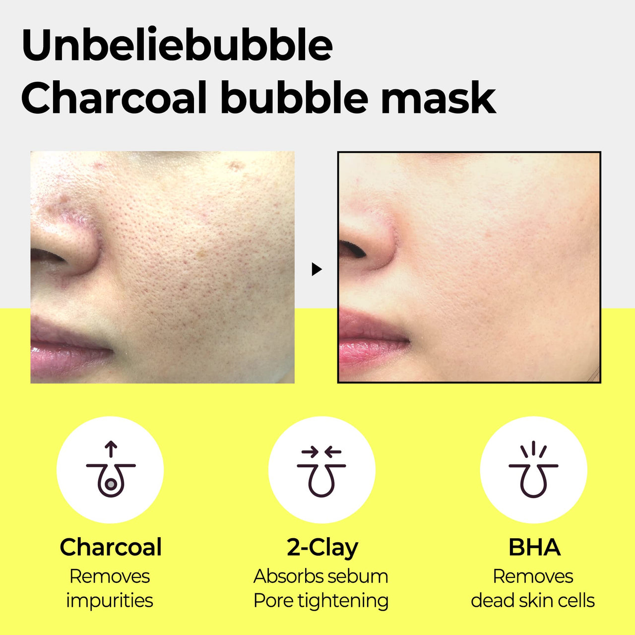 SOME BY MI Charcoal BHA Pore Clay Bubble Mask – 4.23oz, 120g – Korean Exfoliating Face Wash & Bubble Face Mask – Salicylic Acid Cleanser for Sebum and Pore Care with Natural BHA – Korean Skin Care