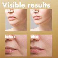 Thumbnail for ISOI Intensive Lifting Serum, Premium Hydrating Serum for Skin Elasticity & Firmness, Instant Face Lift, Daily Care for Face & Neck, Korean Skin Care (1.18 fl. oz, 35ml)