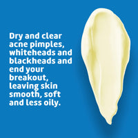 Thumbnail for De La Cruz Sulfur Ointment - Cystic Acne Treatment for Face and Body - Daily 10 Min Spot Treatment Mask - Safe and Effective Game Changing Hormonal Acne Treatment that Clears Up Pimples - 2.6 OZ Tube