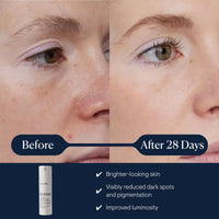 Thumbnail for ELEMIS Dynamic Resurfacing Super-C Serum, Daily Anti-Aging Antioxidant Serum Brightens, Refines, and Illuminates Dull Skin with Vitamin C, 30 mL