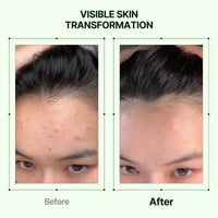 Thumbnail for Orien Mugwort Zero Film Toner 5.41 fl.oz. 160ml ㅣpH5.5 Calming, Soothing, Hydrating Spray Toner