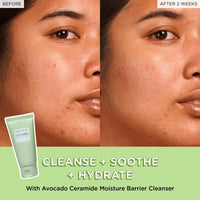 Thumbnail for Glow Recipe Avocado Ceramide Facial Cleanser for Dry Skin - Hydrating Gel to Foaming Face Wash for Women & Men - Gentle Moisture Barrier Repair with Hyaluronic Acid & Colloidal Oatmeal, 150ml