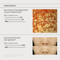 Thumbnail for SOME BY MI Yuja Niacin Anti Blemish Cream - 2.02Oz, 60ml - Daily Face Moisturizer Made from 5% Niacinamide - Advanced Skin Brightening and Pigmentation Care for Dull-Looking Skin - Korean Skin Care