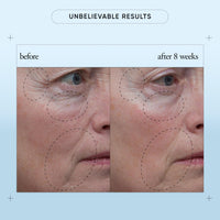 Thumbnail for philosophy when hope is not enough facial firming serum - with vitamins C, E & hyaluronic acid - revitalizes dull complexion while reducing the look of fine lines and wrinkles - 1 fl oz