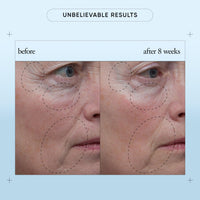 Thumbnail for philosophy when hope is not enough facial firming serum - with vitamins C, E & hyaluronic acid - revitalizes dull complexion while reducing the look of fine lines and wrinkles - 1 fl oz