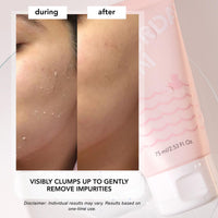 Thumbnail for Saturday Skin Rub-A-Dub Refining Peel Gel – Exfoliating Face Wash & Exfoliating Peel Gel, Fruit Enzyme Exfoliator Facial Enzyme Scrub, Dead Skin Remover for Face,Korean Skincare (2.53 Fl Oz / 75ml)