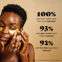 Thumbnail for grace & stella Award Winning Under Eye Mask - Birthday Gifts for Women - Gel Eye Patches for Dark Circles, Puffy Eyes, Wrinkles, Undereye Bags - Gifts for Teen Girls - Vegan (48 Pairs, Gold)