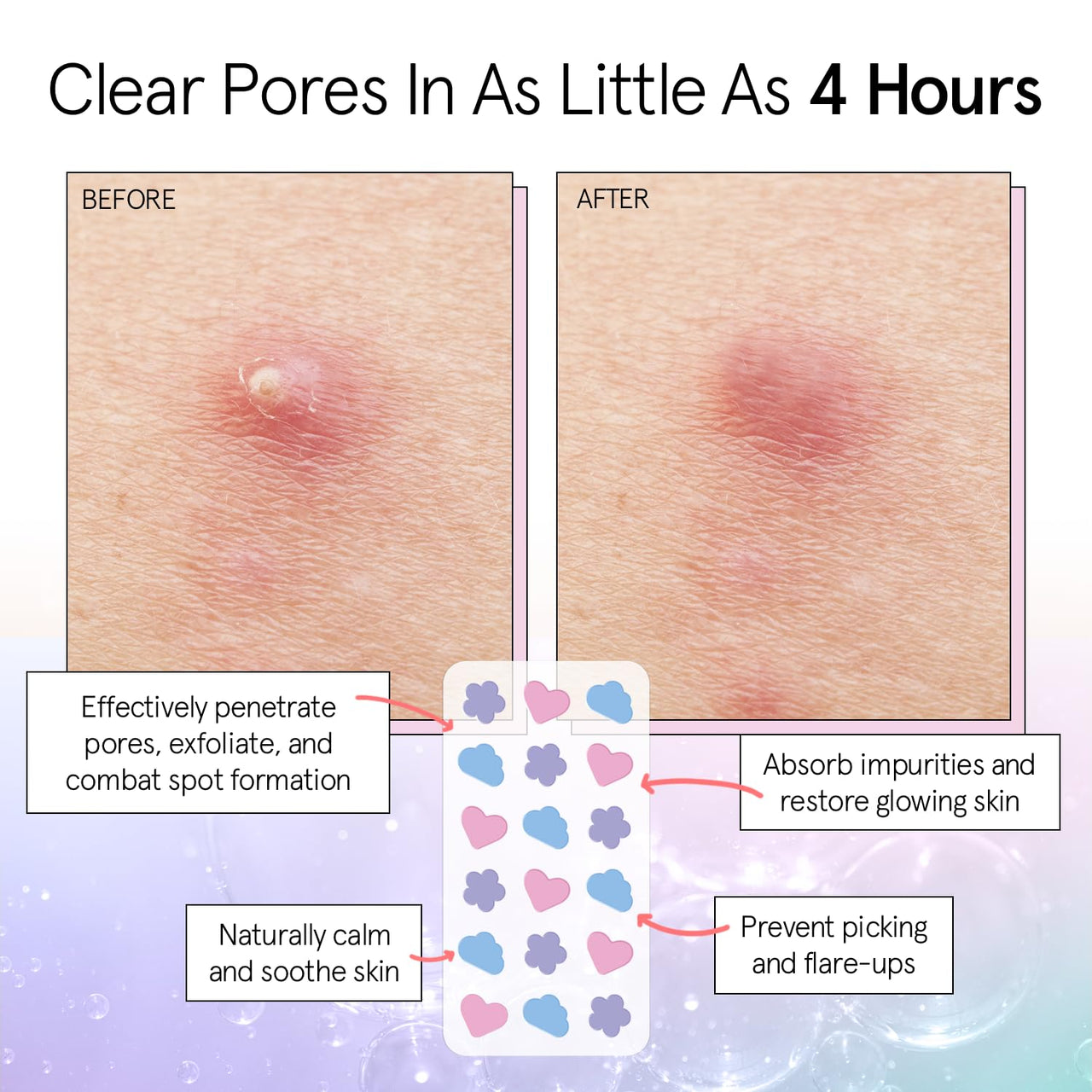 grace & stella Award Winning Pore Strip - Pimple Patches for Face - Hydrocolloid Acne Patches - Absorbs Zits, Reduces Redness - Cute Patches Dermatologist-Tested, Vegan (Multishape, 72 Count)