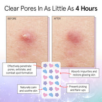 Thumbnail for grace & stella Award Winning Pore Strip - Pimple Patches for Face - Hydrocolloid Acne Patches - Absorbs Zits, Reduces Redness - Cute Patches Dermatologist-Tested, Vegan (Multishape, 72 Count)