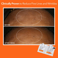 Thumbnail for Dr Dennis Gross Alpha Beta Universal Daily Peel: for Uneven Tone or Texture and Fine Lines or Enlarged Pores, (5 Treatments)