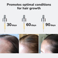 Thumbnail for COLOR WOW Youth Juice Collagen Scalp Treatment – Supports scalp collagen to help keep hair follicles strong and elastic | Creates optimal conditions for growth + stronger, thicker, glossy hair