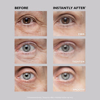 Thumbnail for Peter Thomas Roth | Instant FIRMx® Temporary Eye Tightener | Firm and Smooth the Look of Fine Lines, 1 oz
