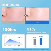 Thumbnail for Illiyoon Ceramide Ato Concentrate Cream | Moisturizer for Dry & Sensitive Skin, 100hr Lasting Hydration, For Face & Body, Gentle for Infants, Moisture Barrier Repair, Vegan Certified, 2.53 fl.oz.