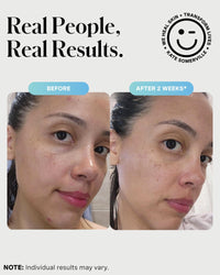 Thumbnail for Kate Somerville EradiKate 3% Sulfur Daily Foaming Cleanser Acne Treatment – Clinically Formulated Medicated Face Wash Balances Skin & Cleans Pores, 4 Fl Oz