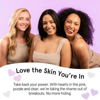 Thumbnail for grace & stella Award Winning Pore Strip - Pimple Patches for Face - Heart Hydrocolloid Zit Stickers that Help Soothe & Conceal Breakouts - Cute Patches - Dermatologist-Tested, Vegan (Heart, 72 Count)
