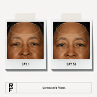 Thumbnail for Rodan + Fields Redefine Regimen | Skincare Kit Includes Clay Cleanser, Toner, Triple Defense Cream, & Overnight Cream | Skin Care Gift Set for Women