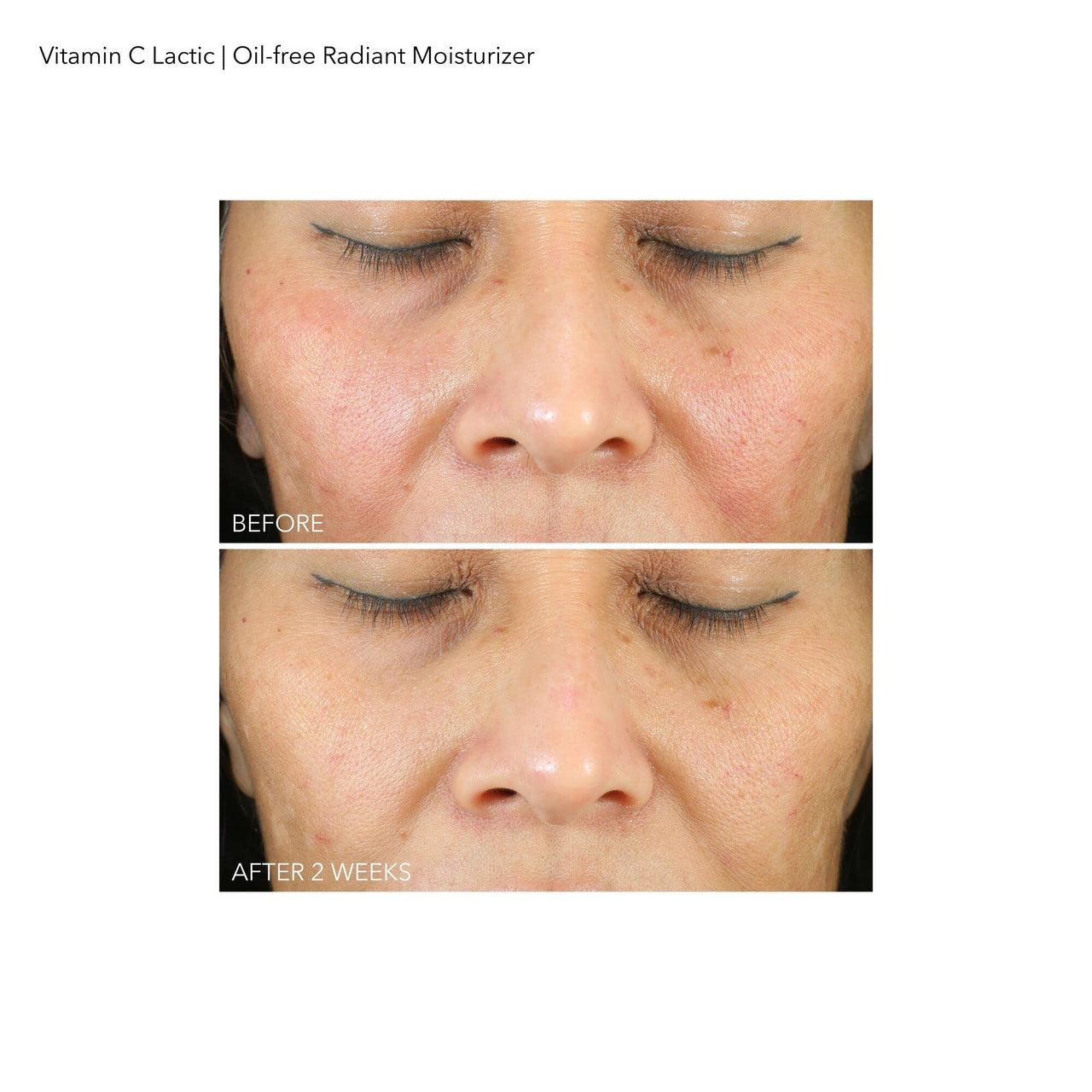 Dr Dennis Gross VitC+Lactic Oil-Free Radiant Moisturizer, 1.7 fl oz/50ml