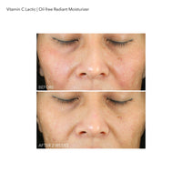 Thumbnail for Dr Dennis Gross VitC+Lactic Oil-Free Radiant Moisturizer, 1.7 fl oz/50ml