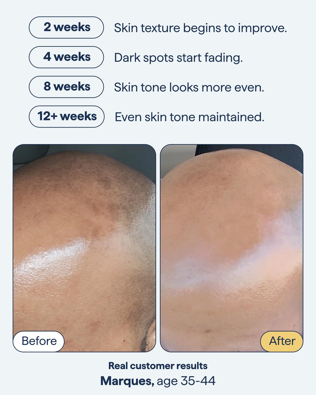 Remedy Vitamin C Daily Defense and Dark Spots Serum Duo | Even Tone, Brightening & Correcting Set | Ferulic Acid, Tranexamic Acid, Retinol, Kojic Acid | By Dermatologist Dr. Shah | 2 x 1 fl oz