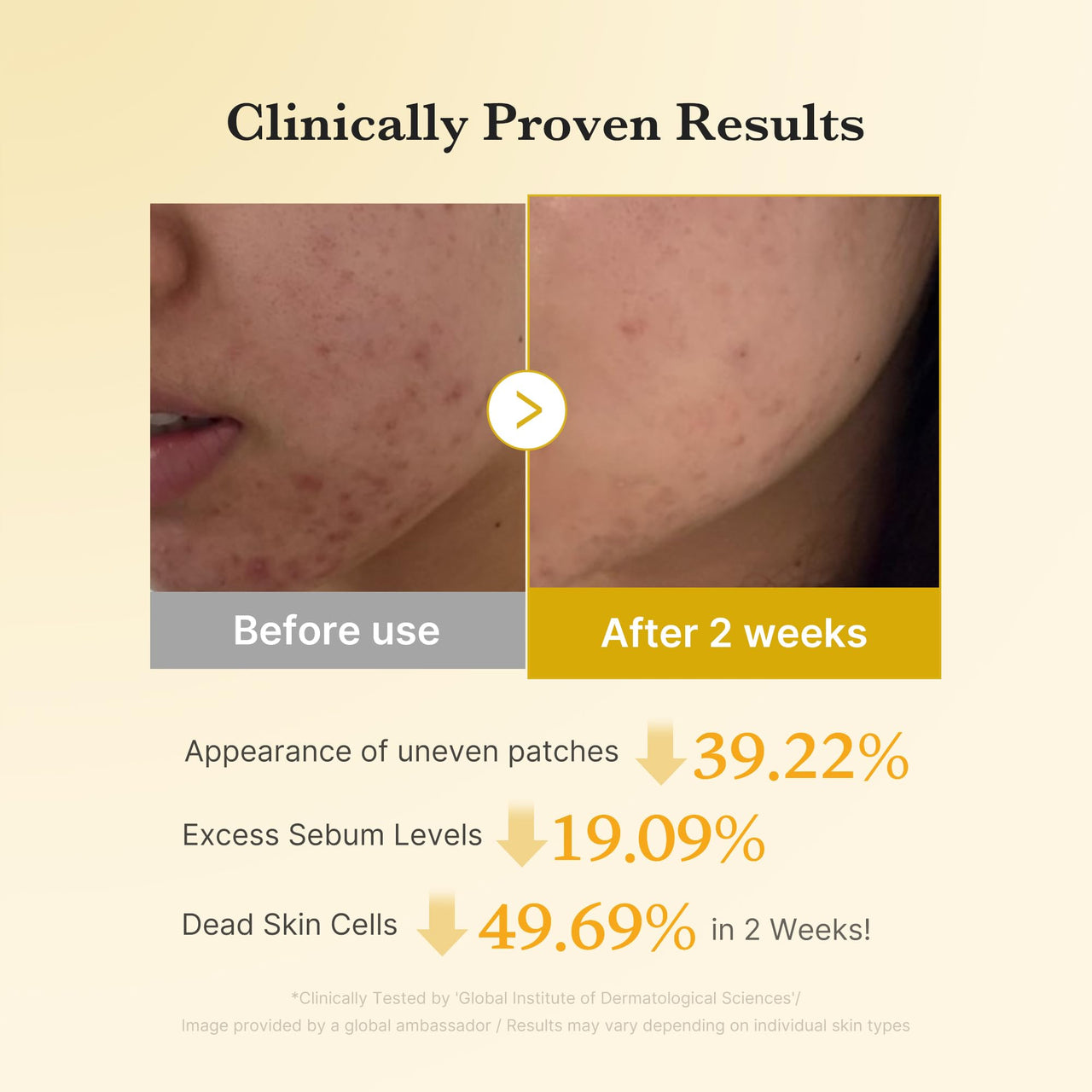 medicube Kojic Acid Turmeric Clarifying Toner Pad for Troubled Skin & Use After Spot Care, Soothing & Calming with Kojic Acid, Turmeric, Niacinamide & Glycolic Acid, Korean Skin Care, 70 Pads, 1 Pack