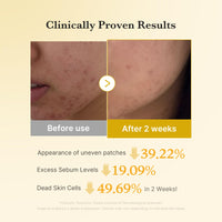 Thumbnail for medicube Kojic Acid Turmeric Clarifying Toner Pad for Troubled Skin & Use After Spot Care, Soothing & Calming with Kojic Acid, Turmeric, Niacinamide & Glycolic Acid, Korean Skin Care, 70 Pads, 1 Pack