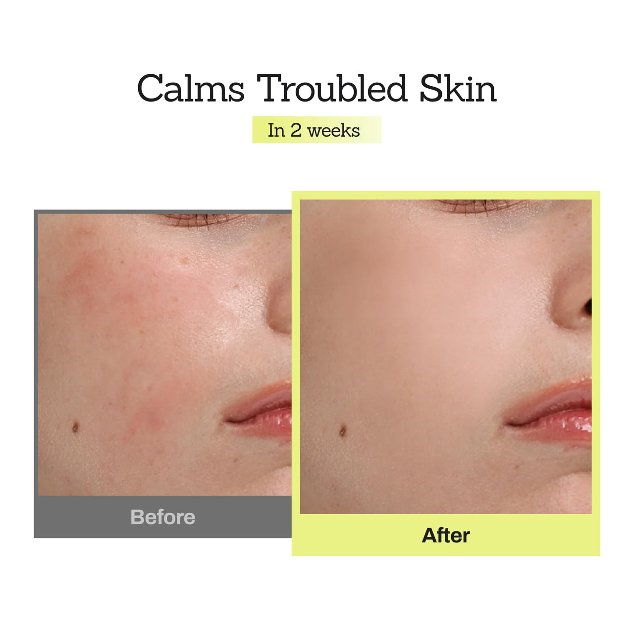 MEDITHERAPY Mugwort D-Panthenol 30 Calming Serum, High Concentration for Skin Barrier & Deep Calming, Pure Ingredients, Korean Skincare 1.01 fl.oz