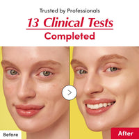 Thumbnail for EQQUALBERRY Vitamin Illuminating Serum – Brightening Vitamin C Serum with Niacinamide | Strengthens skin barrier | Hydrates using Ceramide and Hyaluronic Acid, 1.01oz / 30ml