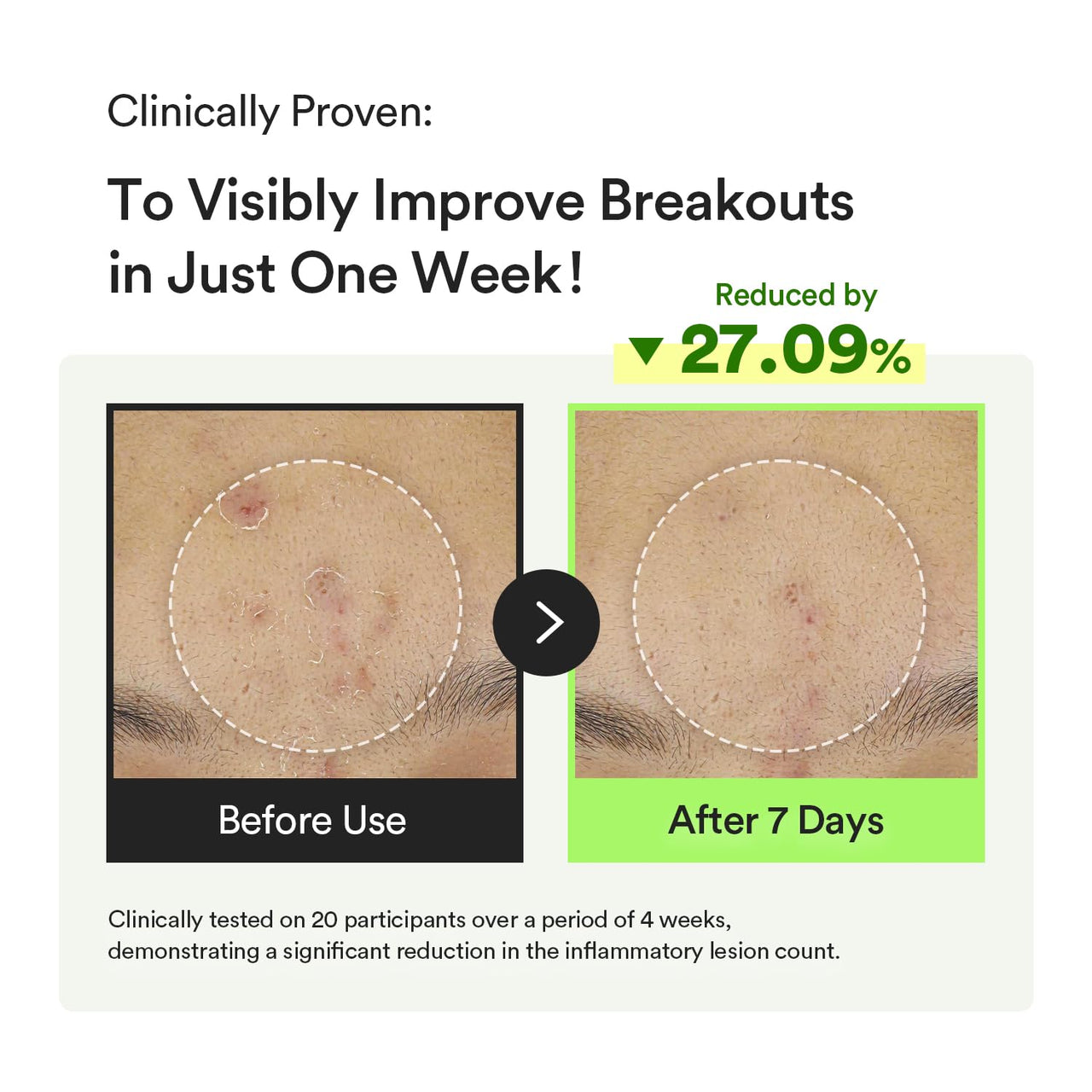 Abib Heartleaf Teca Capsule Serum Calming Drop 1.69 fl oz, Centella Asiatica & Niacinamide Serum for Soothing, Acne Treatment for Face, Korean Skin Care for Oily Skin