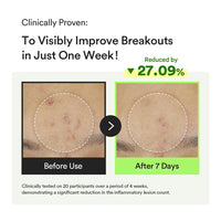 Thumbnail for Abib Heartleaf Teca Capsule Serum Calming Drop 1.69 fl oz, Centella Asiatica & Niacinamide Serum for Soothing, Acne Treatment for Face, Korean Skin Care for Oily Skin