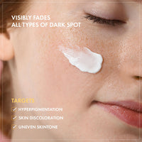 Thumbnail for TOSOWOONG 8 Days Spot Cream, Dark Spot Remover for Face, Age Spot, Sun Spot, Freckles, Melasma, Brown Spot Serum, Advanced Formula Corrector Cream with Niacinamide for Women and Men, 50g, 1.76 oz.