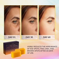 Thumbnail for VALITIC Kojic Acid Dark Spot Remover Soap Bars with Vitamin C, Retinol, Collagen, Turmeric - Original Japanese Complex Infused Hyaluronic Acid, E, Shea Butter, Castile Olive Oil (4 Pack)